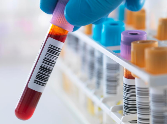 Xét nghiệm Thalassemia là gì?