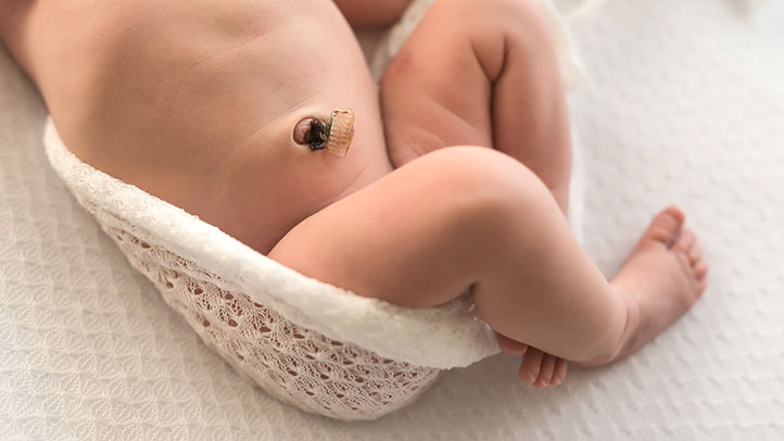 Làm sao giảm nguy cơ uốn ván khi cắt dây rốn?