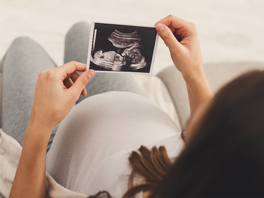 Làm thế nào để biết bị thiểu ối?