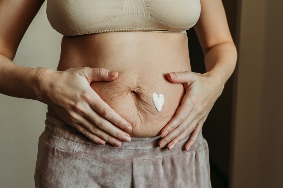 Khi nào bụng mỡ sau sinh mới biến mất?
