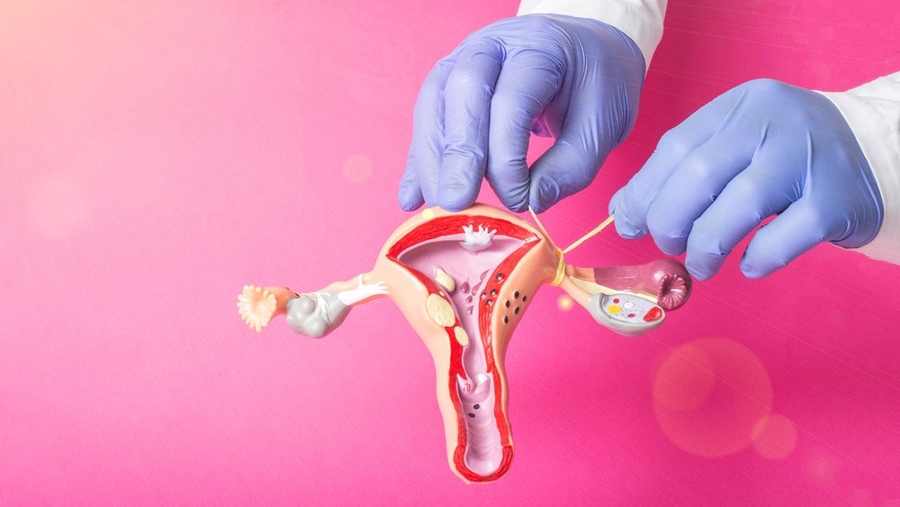 Triệt sản ở nữ: Quyết định quan trọng và điều cần biết
