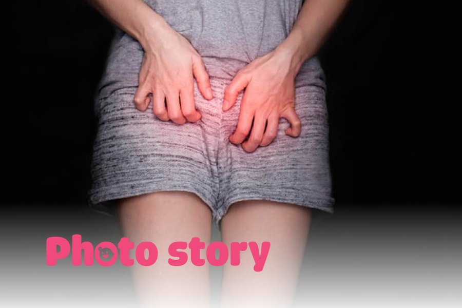 Mẹo giúp mẹ bầu trị hăm bẹn mùa nóng